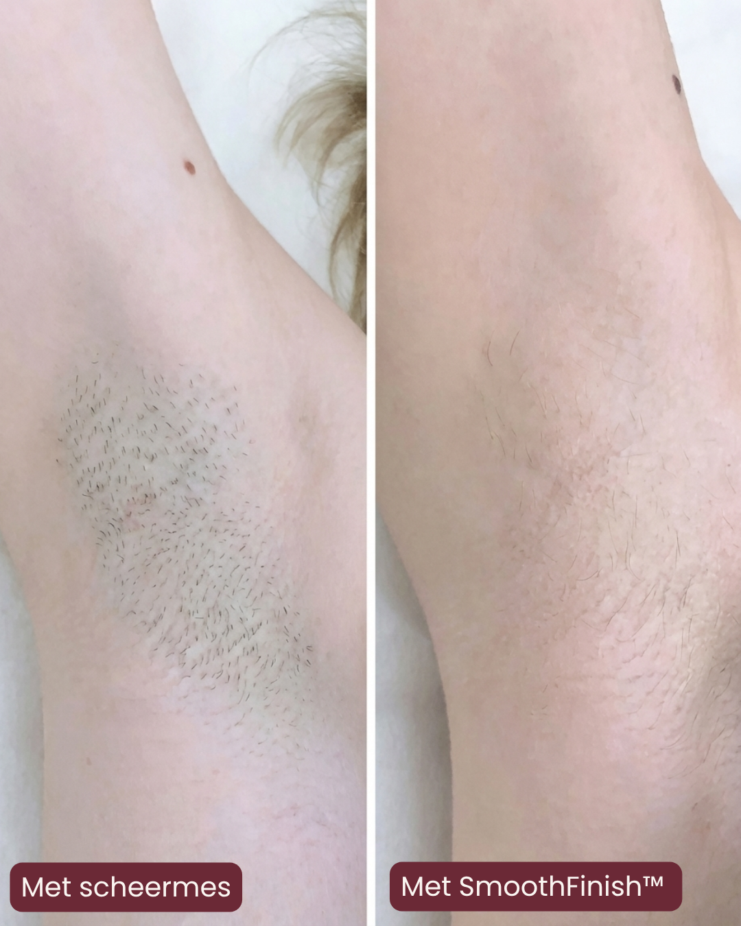 Velvyna SmoothFinish™ 2-in-1 Ladyshaver