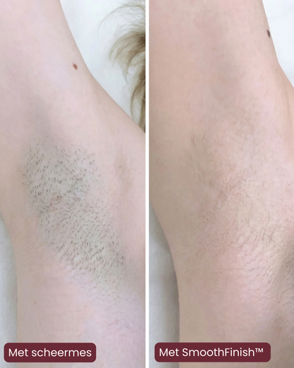 Velvyna SmoothFinish™ 2-in-1 Ladyshaver